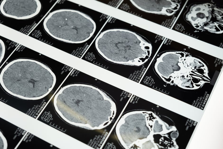 how does entertainment affect the brain
